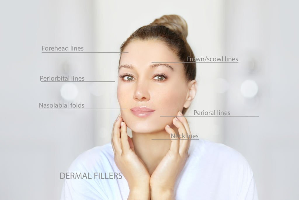 Dermal Fillers